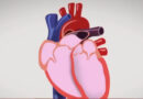 Setembro Vermelho: Doenças cardiovasculares são uma das principais causas de morte no mundo