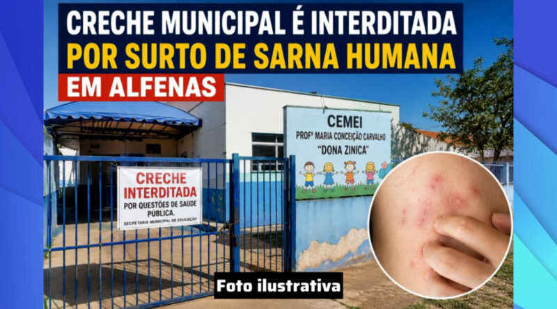 Prefeitura de Alfenas amplia ações e medica mais de 200 pessoas após surto de sarna em creches