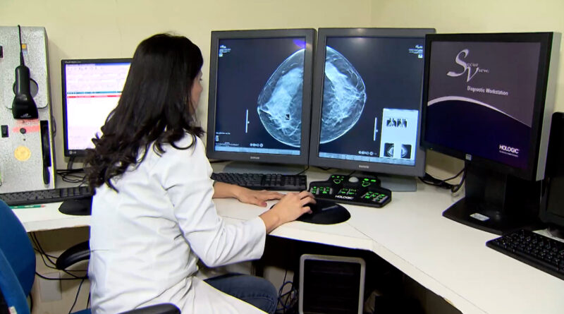 Planos de saúde passam a ter que cobrir mamografia digital sem restrição de idade